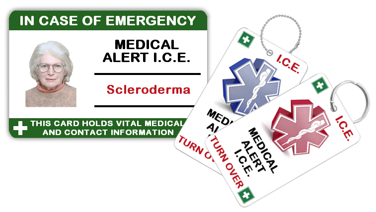 Scleroderma - Adult