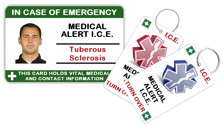 Tuberous Sclerosis - Adult